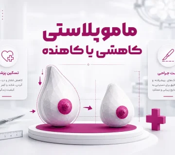 ماموپلاستی کاهشی یا کاهنده
