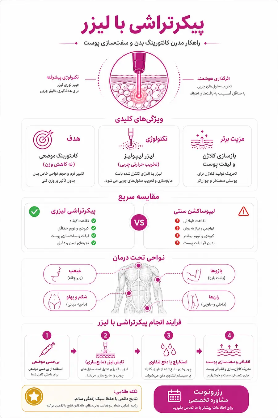 اینفوگرافیک - پیکرتراشی با لیزر