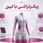پیکرتراشی با لیزر