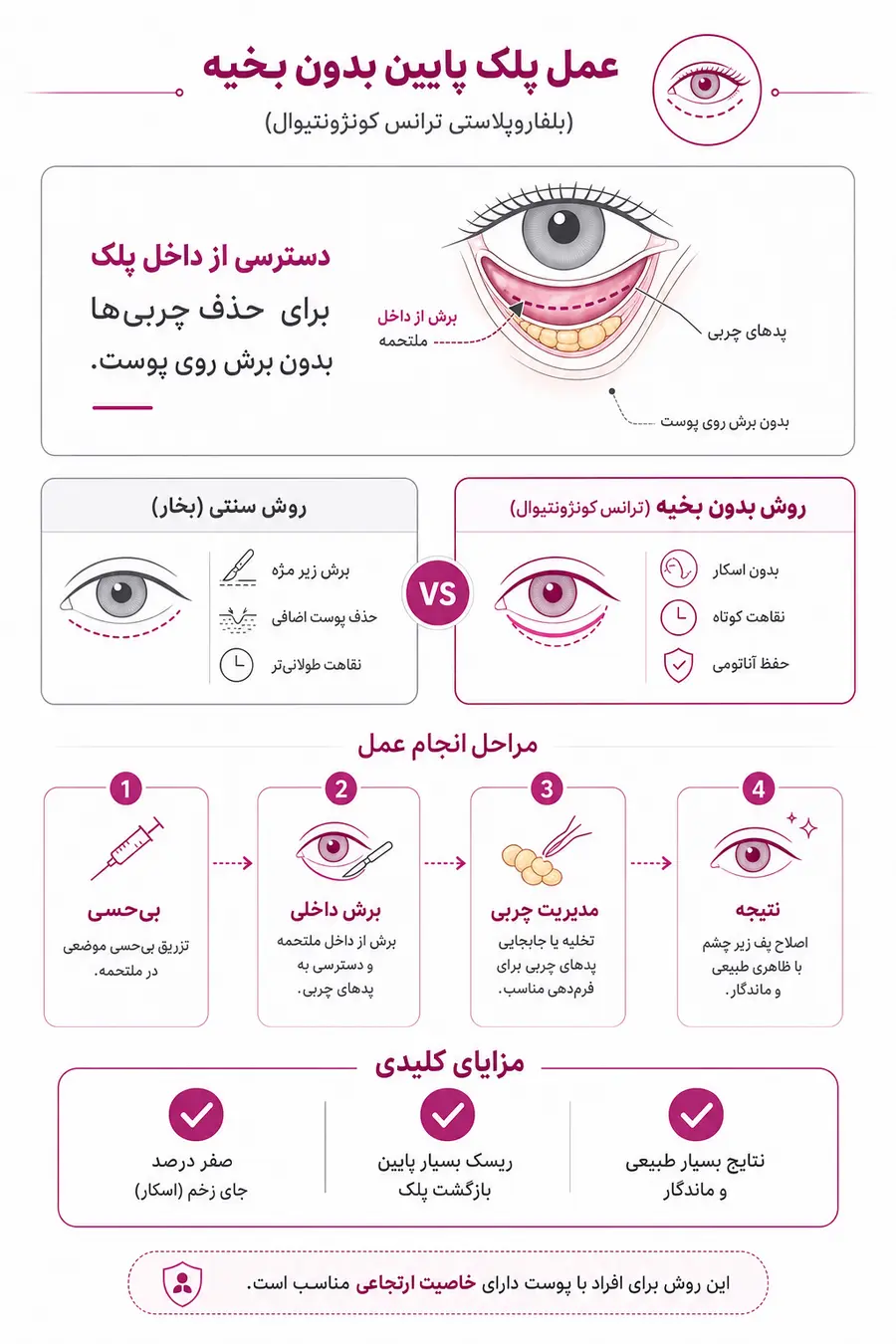 اینفوگرافیک عمل پلک پایین بدون بخیه