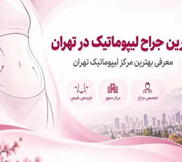 بهترین جراح لیپوماتیک در تهران؛ معرفی بهترین مرکز لیپوماتیک تهران