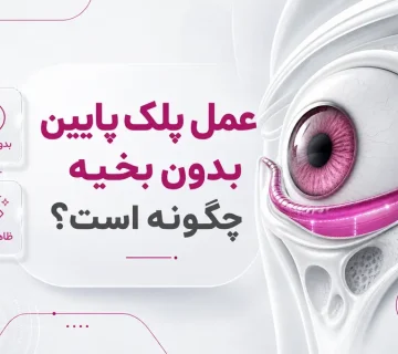 عمل پلک پایین بدون بخیه چگونه است؟ بلفاروپلاستی پلک پایین بدون بخیه
