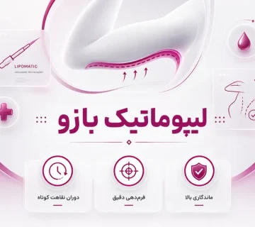 لیپوماتیک بازو
