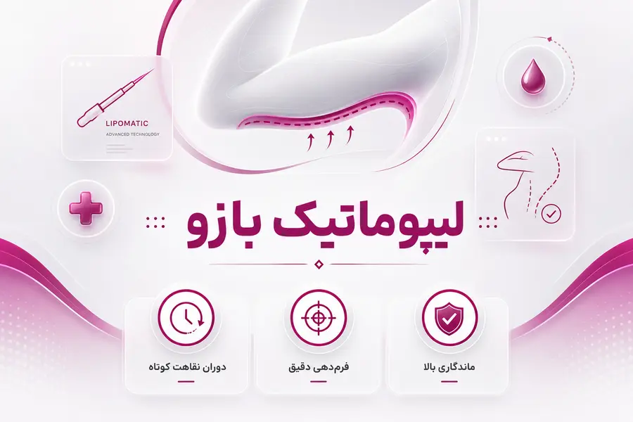 شاخص - لیپوماتیک بازو لیپوماتیک بازو