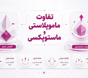 تفاوت ماموپلاستی و ماستوپکسی چیست؟ مقایسه کوچک کردن و لیفت سینه