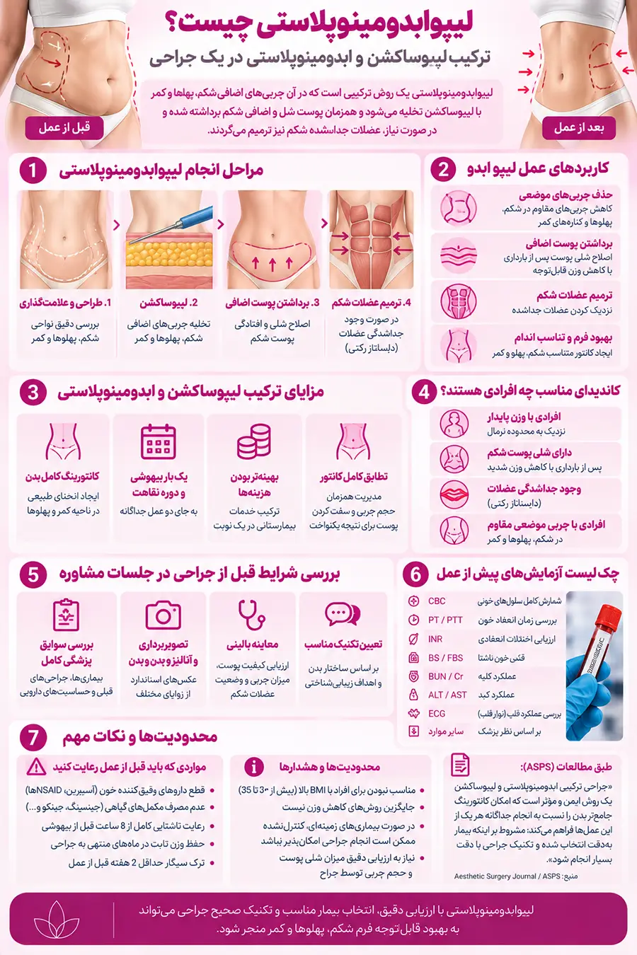 عمل لیپو ابدو چیست؟ کاربرد، مزایا و مراحل جراحی لیپوابدومینوپلاستی