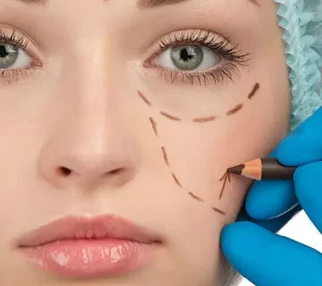 عمل پلک پایین بدون بخیه