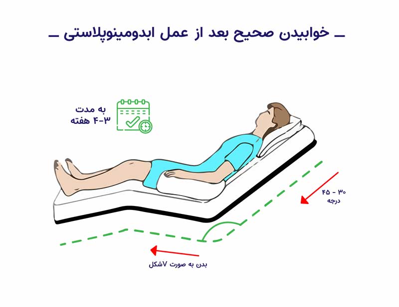 نحوه خوابیدن بعد از عمل ابدومینوپلاستی