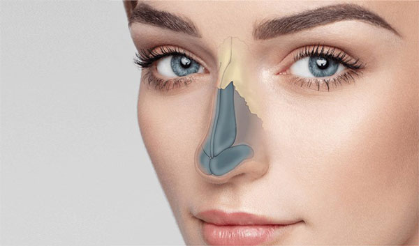 همه چیز درباره جراحی بینی