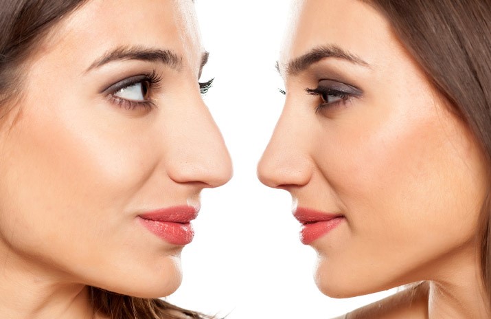 همه چیز درباره جراحی بینی