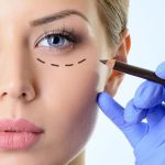 عمل پلک پایین بدون بخیه عمل پلک پایین بدون بخیه چگونه است؟