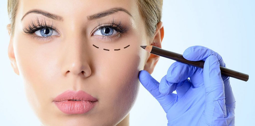 عمل پلک پایین بدون بخیه چگونه است؟