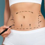 بررسی روش‌های مختلف لیپوساکشن