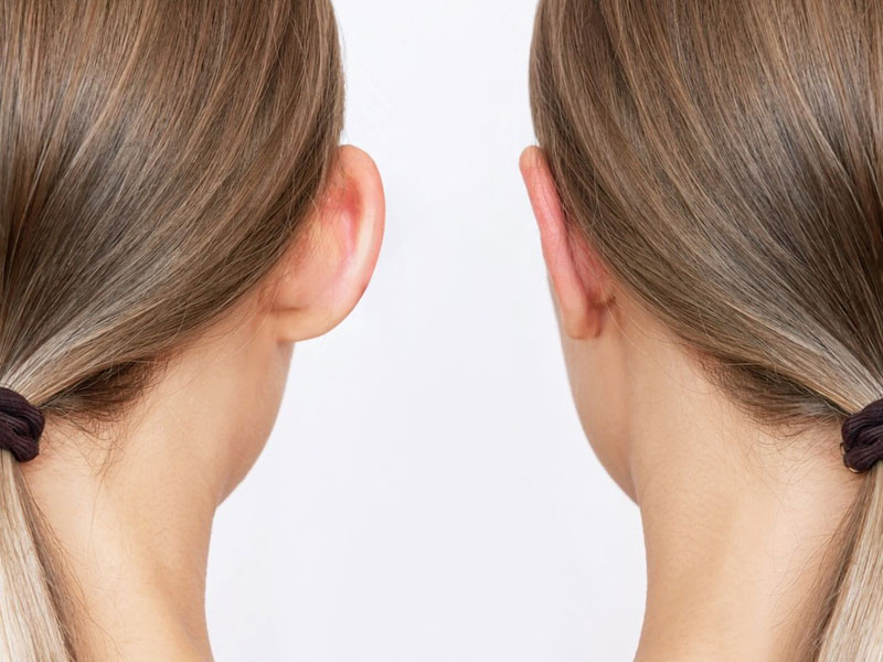 تکنیکهای عمل اتوپلاستی - دکتر فرخ سواددار