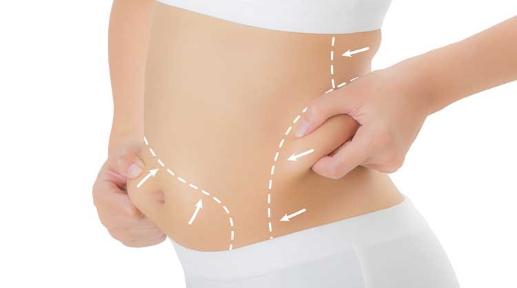 عکس لیپوماتیک  چیست؟