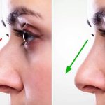 تاثیرات روانی و اجتماع رینوپلاستیی جراحی