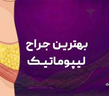 بهترین جراح لیپوماتیک در قم