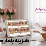 هزینه بلفاروپلاستی