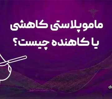 ماموپلاستی کاهشی یا کاهنده چیست؟