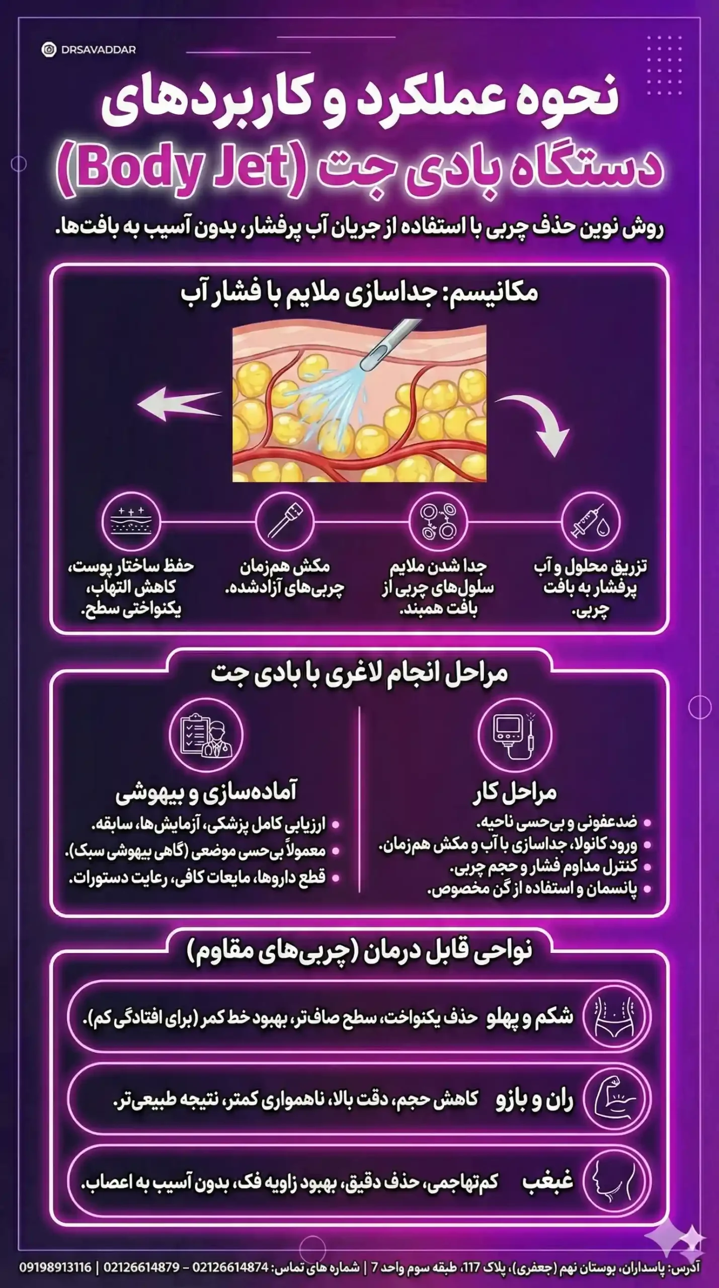 نحوه عملکرد دستگاه بادی جت