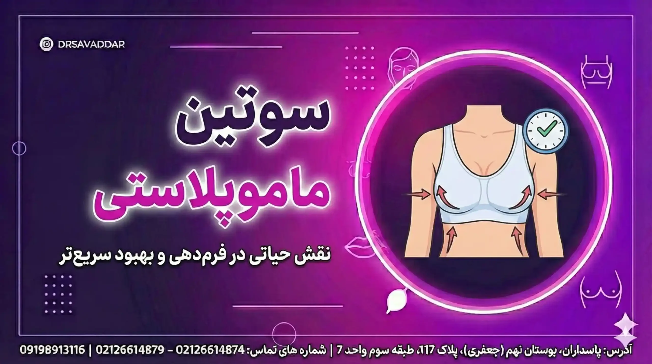 سوتین ماموپلاستی