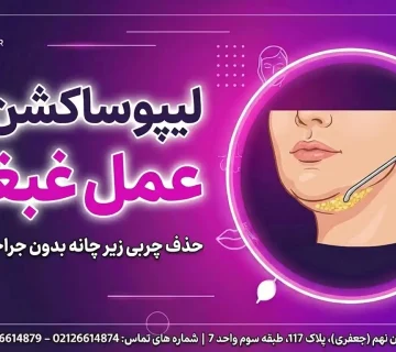 لیپوساکشن غبغب