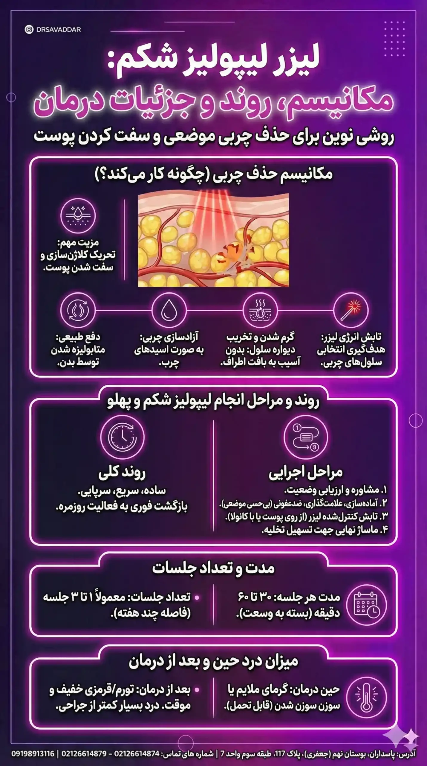 روش لیزر لیپولیز شکم