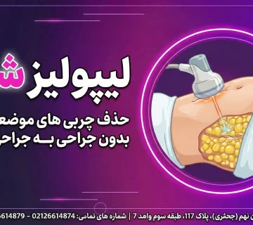 لیپولیز شکم
