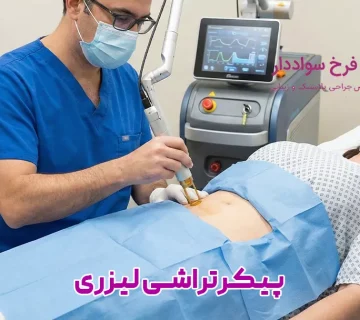 پیکرتراشی لیزری