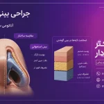 آناتومی ساختار بینی گوشتی و ضخامت لایه‌های پوستی در مقایسه با بافت غضروفی در عمل بینی گوشتی