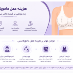 هزینه عمل ماموپلاستی