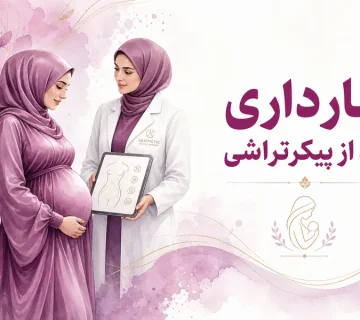 بارداری بعد از پیکرتراشی