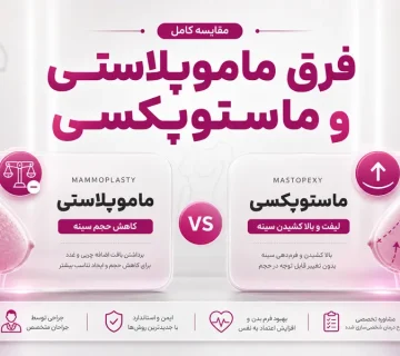 تفاوت عمل ماموپلاستی و ماستوپکسی