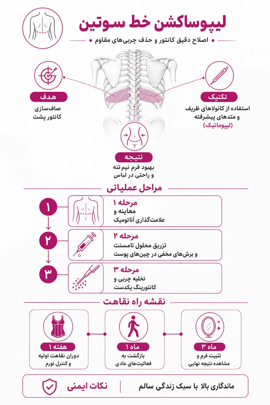 اینفوگرافیک - فرآیند انجام، مزایا و معایب لیپوساکشن خط سوتین