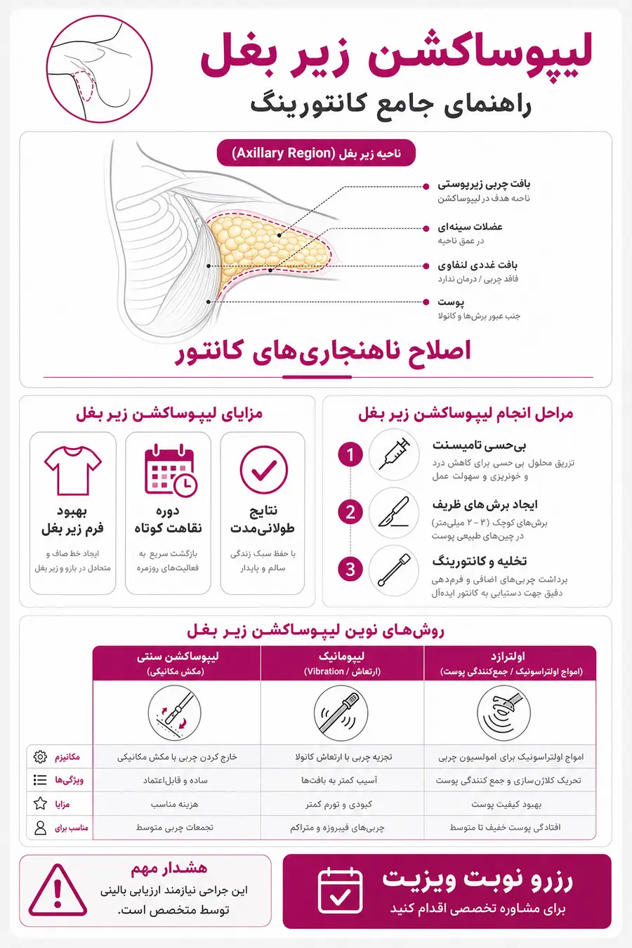 اینفوگرافیک - روش انجام، مزایا و کاندیدای مناسب لیپوساکشن زیر بغل 