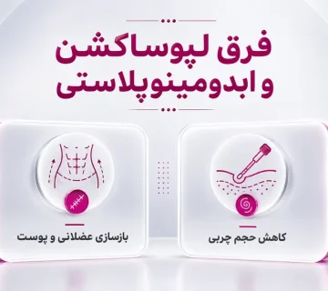 فرق لیپوساکشن و ابدومینوپلاستی
