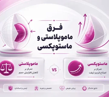 فرق ماموپلاستی و ماستوپکسی