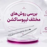 بررسی روش_های مختلف لیپوساکشن