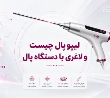 لیپو پال