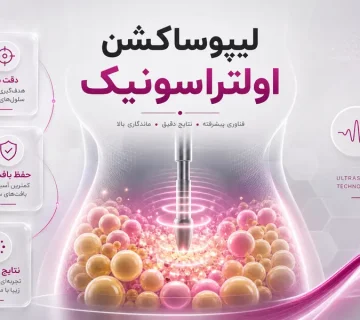 لیپوساکشن اولتراسونیک