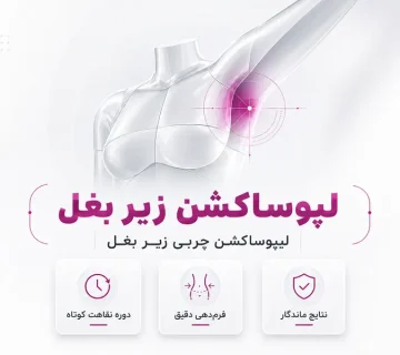 لیپوساکشن زیر بغل _ لیپوساکشن چربی زیر بغل