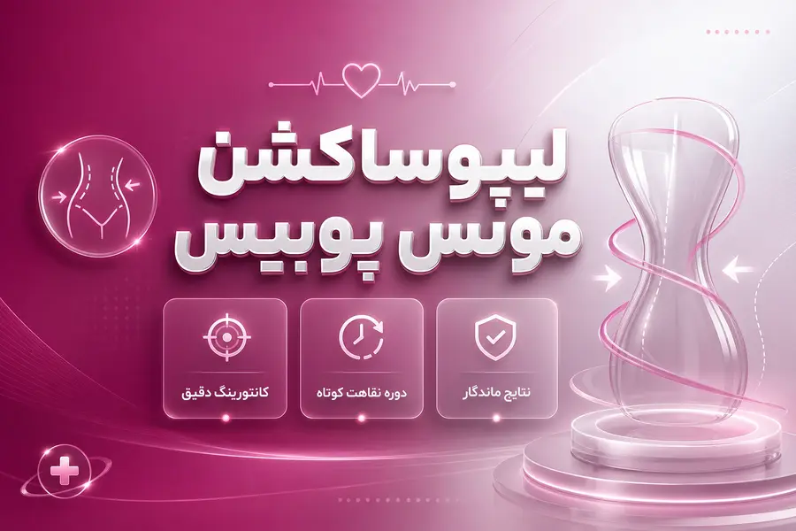 لیپوساکشن مونس پوبیس