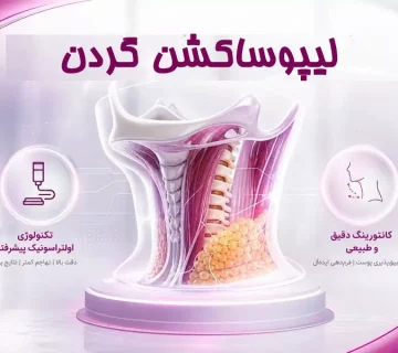 لیپوساکشن گردن