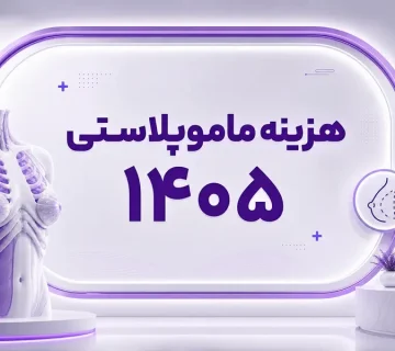 هزینه عمل ماموپلاستی در تهران