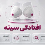 افتادگی سینه