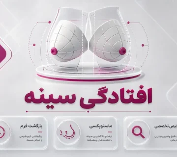 افتادگی سینه