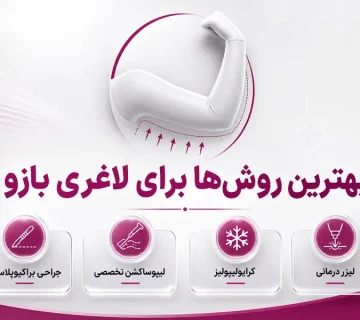 بهترین روش‌ها برای لاغری بازو