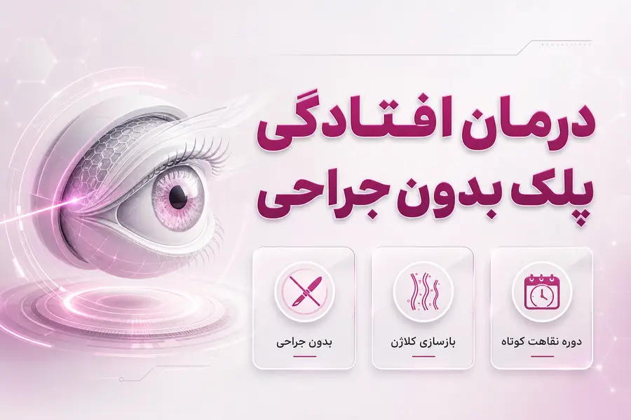 درمان افتادگی پلک بدون جراحی؛ آیا بلفاروپلاستی بدون جراحی ممکن است؟ درمان افتادگی پلک بدون جراحی؛ آیا بلفاروپلاستی بدون جراحی ممکن است؟