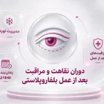 دوران نقاهت بلفاروپلاستی؛ مراقبت بعد از عمل زیبایی پلک چیست؟