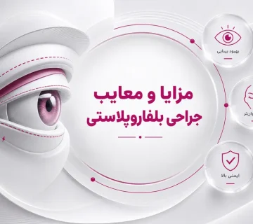 مزایا و معایب جراحی بلفاروپلاستی؛ مزیت ها و خطرات جراحی زیبایی چشم